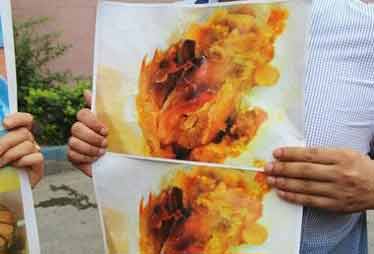 孕婦與侄女吃肯德基后雙雙中毒 公司暫無(wú)說(shuō)法