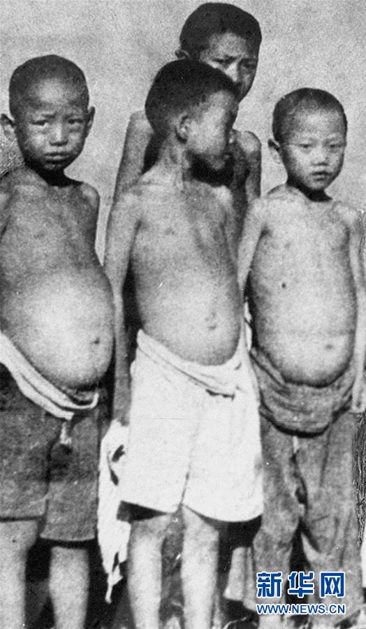 （紅土地&ldquo;往事新說&rdquo;&middot;圖文互動(dòng)）（6）昔日送&ldquo;瘟神&rdquo;  今朝健康促小康