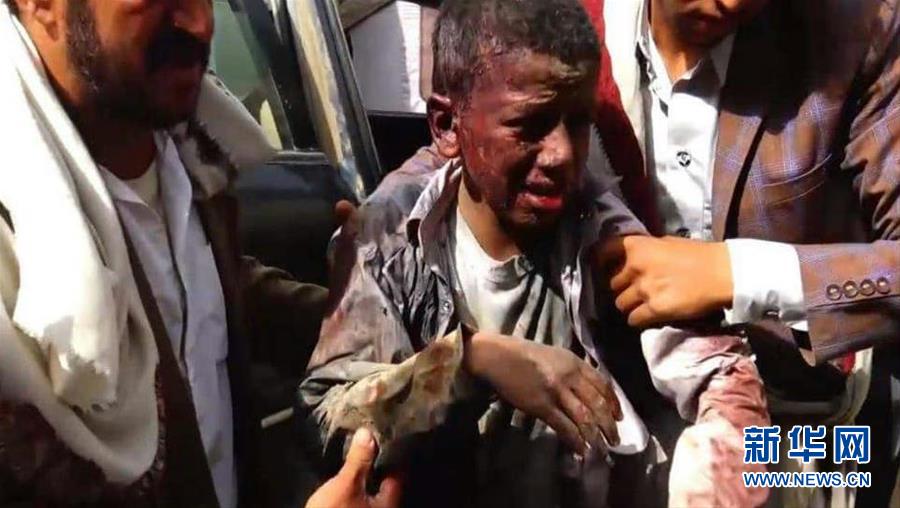 （國(guó)際&middot;一周看天下）遭遇空襲的孩子